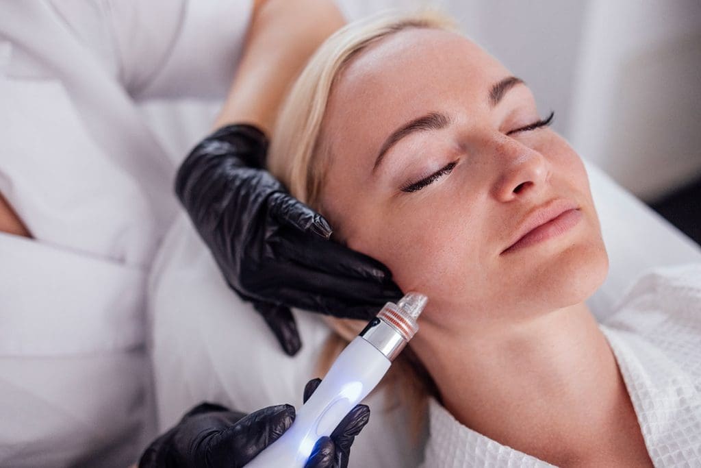 microneedling seo