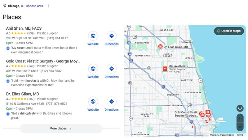 An example of when a  patient searches "rhinoplasty in Chicago" and three names win. Local cosmetic surgery SEO determines who makes the list.